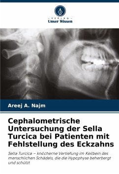 Cephalometrische Untersuchung der Sella Turcica bei Patienten mit Fehlstellung des Eckzahns - A. Najm, Areej Cephalometrische Untersuchung der Sella Turcica bei Patienten mit Fehlstellung des Eckzahns - A. Najm, Areej
