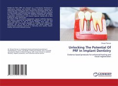 Unlocking The Potential Of PRF In Implant Dentistry Unlocking The Potential Of PRF In Implant Dentistry