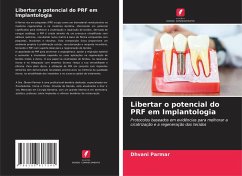 Libertar o potencial do PRF em Implantologia - Parmar, Dhvani Libertar o potencial do PRF em Implantologia - Parmar, Dhvani