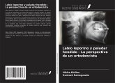 Labio leporino y paladar hendido - La perspectiva de un ortodoncista Labio leporino y paladar hendido - La perspectiva de un ortodoncista