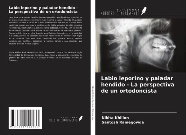 Labio leporino y paladar hendido - La perspectiva de un ortodoncista