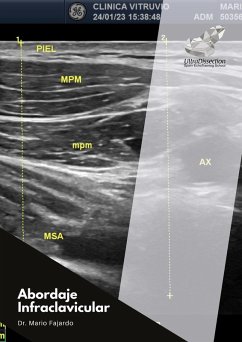 Cover Abordaje Infraclavicular (eBook, ePUB)