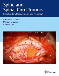 Spine and Spinal Cord Tumors (eBook, ePUB) - Fanous, Andrew; Wang, Michael; Levi, Allan