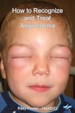 HowtoRecognizeandTreatAngioedema (eBook, ePUB) HowtoRecognizeandTreatAngioedema (eBook, ePUB)
