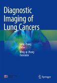 Diagnostic Imaging of Lung Cancers Diagnostic Imaging of Lung Cancers