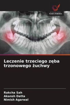 Leczenie trzeciego z¿ba trzonowego ¿uchwy - SAH, RAKCHA;DATTA, AKANSH;Agarwal, Nimish