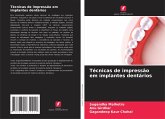 Técnicas de impressão em implantes dentários Técnicas de impressão em implantes dentários