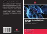Nanopartículas lipídicas sólidas Nanopartículas lipídicas sólidas