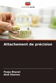 Attachement de précision Attachement de précision