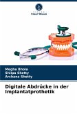 Digitale Abdrücke in der Implantatprothetik Digitale Abdrücke in der Implantatprothetik