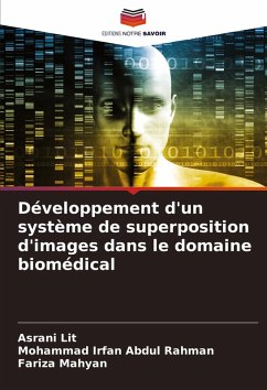 Cover Développement d'un système de superposition d'images dans le domaine biomédical