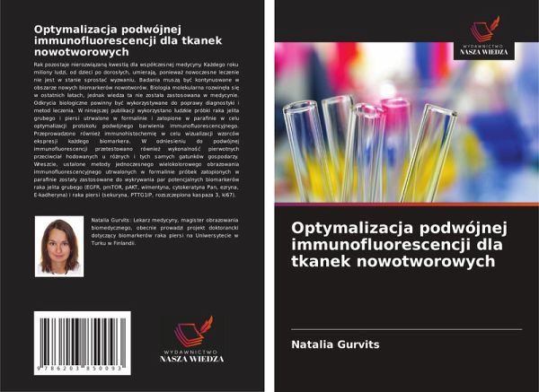 Optymalizacja podwójnej immunofluorescencji dla tkanek nowotworowych Optymalizacja podwójnej immunofluorescencji dla tkanek nowotworowych