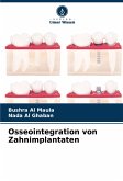 Osseointegration von Zahnimplantaten Osseointegration von Zahnimplantaten