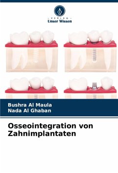 Cover Osseointegration von Zahnimplantaten