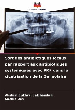 Cover Sort des antibiotiques locaux par rapport aux antibiotiques systémiques avec PRF dans la cicatrisation de la 3e molaire