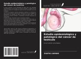 Estudio epidemiológico y patológico del cáncer de testículo Estudio epidemiológico y patológico del cáncer de testículo