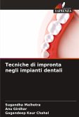 Tecniche di impronta negli impianti dentali Tecniche di impronta negli impianti dentali