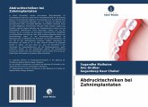 Abdrucktechniken bei Zahnimplantaten Abdrucktechniken bei Zahnimplantaten