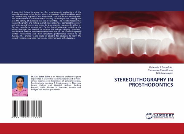 STEREOLITHOGRAPHY IN PROSTHODONTICS STEREOLITHOGRAPHY IN PROSTHODONTICS