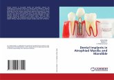 Dental Implants in Atrophied Maxilla and Mandible Dental Implants in Atrophied Maxilla and Mandible