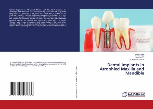 Dental Implants in Atrophied Maxilla and Mandible Dental Implants in Atrophied Maxilla and Mandible