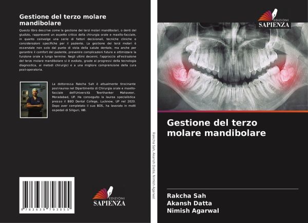 Gestione del terzo molare mandibolare Gestione del terzo molare mandibolare