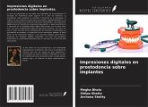 Impresiones digitales en prostodoncia sobre implantes Impresiones digitales en prostodoncia sobre implantes