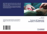 Fracture Of Zygomatic Complex: A Clinical Guide Fracture Of Zygomatic Complex: A Clinical Guide