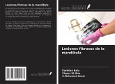 Lesiones fibrosas de la mandíbula Lesiones fibrosas de la mandíbula