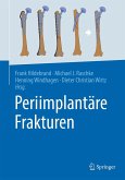 Periimplantäre Frakturen (eBook, PDF) Periimplantäre Frakturen (eBook, PDF)