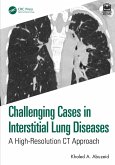 Challenging Cases in Interstitial Lung Diseases (eBook, ePUB)