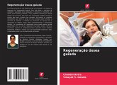Regeneração óssea guiada Regeneração óssea guiada