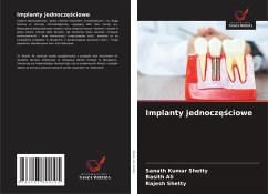 Cover Implanty jednocz¿¿ciowe