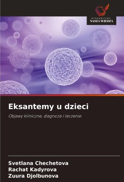 Eksantemy u dzieci - Chechetova, Svetlana;Kadyrova, Rachat;Djolbunova, Zuura