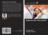 Regeneración ósea guiada Regeneración ósea guiada