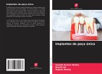 Implantes de peça única
