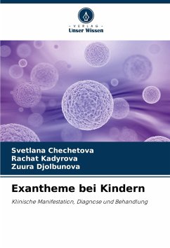 Exantheme bei Kindern - Chechetova, Svetlana;Kadyrova, Rachat;Djolbunova, Zuura Exantheme bei Kindern - Chechetova, Svetlana;Kadyrova, Rachat;Djolbunova, Zuura