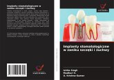 Implanty stomatologiczne w zaniku szcz¿ki i ¿uchwy Implanty stomatologiczne w zaniku szcz¿ki i ¿uchwy