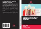 Implantes dentários em maxilas e mandíbulas atrofiadas