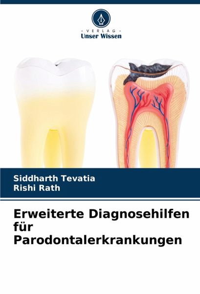 Erweiterte Diagnosehilfen für Parodontalerkrankungen Erweiterte Diagnosehilfen für Parodontalerkrankungen