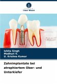 Zahnimplantate bei atrophiertem Ober- und Unterkiefer Zahnimplantate bei atrophiertem Ober- und Unterkiefer
