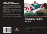 Fracture du complexe zygomatique : Un guide clinique Fracture du complexe zygomatique : Un guide clinique