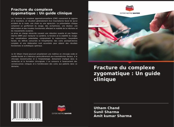 Fracture du complexe zygomatique : Un guide clinique Fracture du complexe zygomatique : Un guide clinique