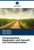 Vergangenheit, Gegenwart und Zukunft von Zahnimplantaten Vergangenheit, Gegenwart und Zukunft von Zahnimplantaten