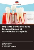 Implants dentaires dans les maxillaires et mandibules atrophiés Implants dentaires dans les maxillaires et mandibules atrophiés