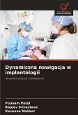 Dynamiczna nawigacja w implantologii Dynamiczna nawigacja w implantologii