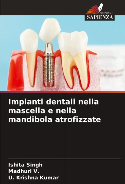Impianti dentali nella mascella e nella mandibola atrofizzate