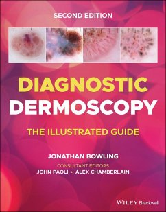 Cover Diagnostic Dermoscopy (eBook, ePUB)