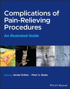 Cover Complications of Pain-Relieving Procedures (eBook, ePUB)