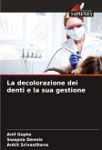 La decolorazione dei denti e la sua gestione La decolorazione dei denti e la sua gestione